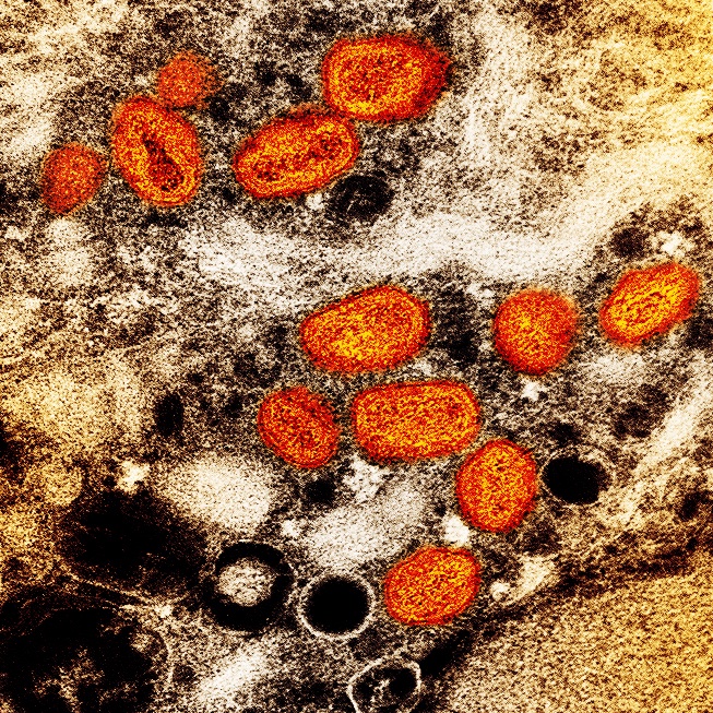  This is a colorized transmission electron microscopic image of mpox virus particles (orange), which were found within an infected cell 