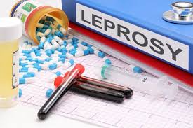 Leprosy