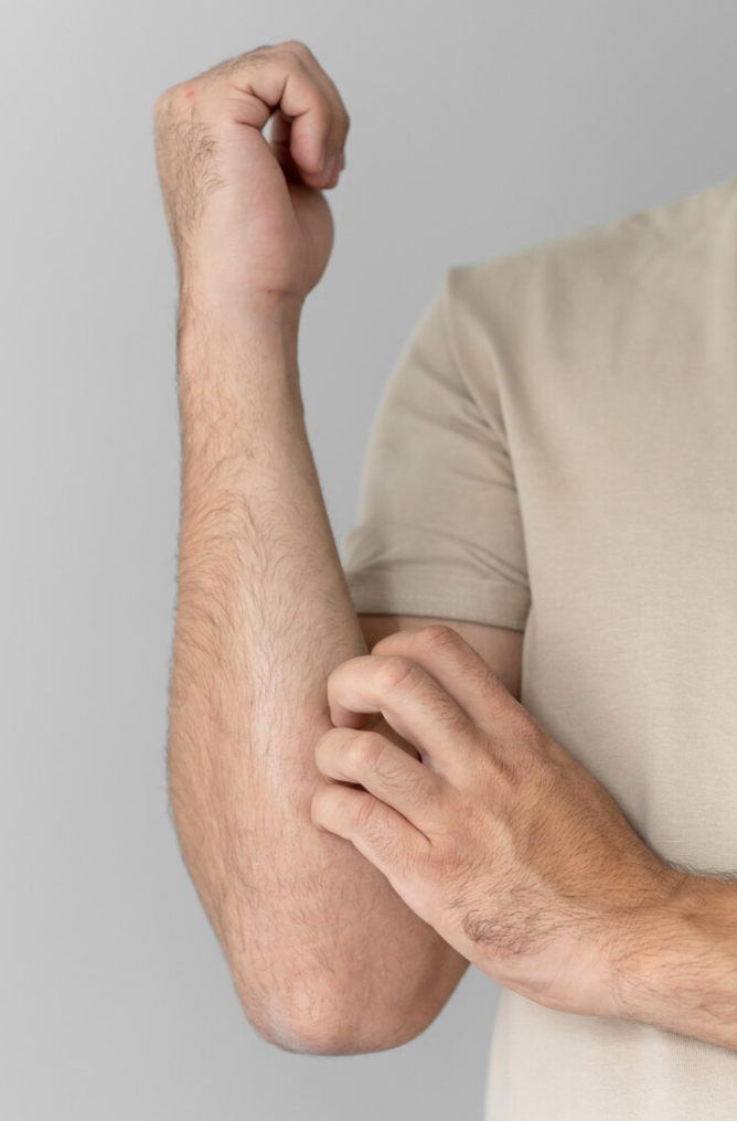 Rash scratching 