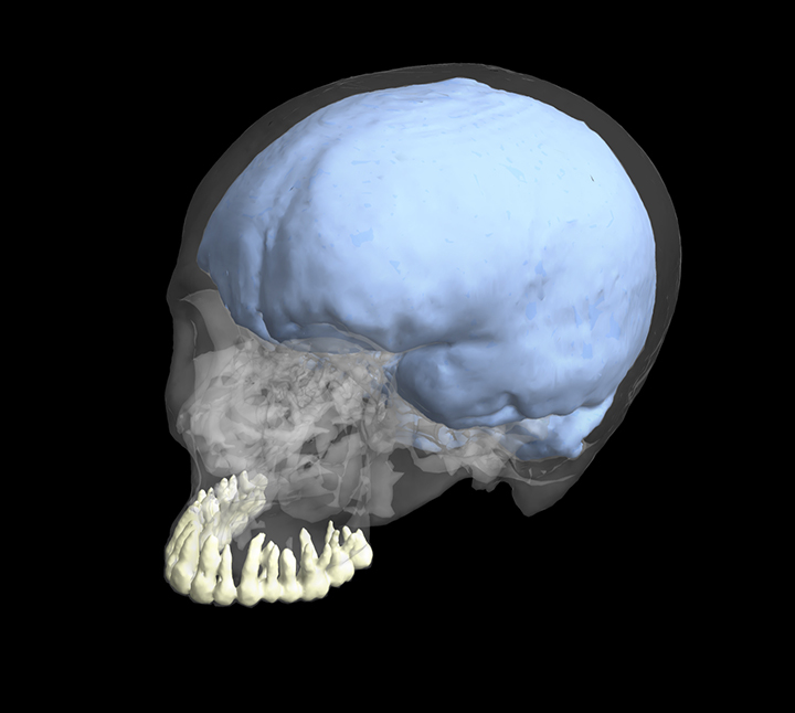 3D reconstruction of a modern human cranium showing the teeth and endocranial cast