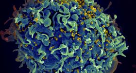 HIV, the AIDS virus (yellow), infecting a human cell