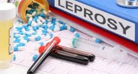Leprosy