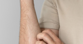 Rash scratching 
